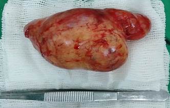 Cirugía. A: pieza anatómica.