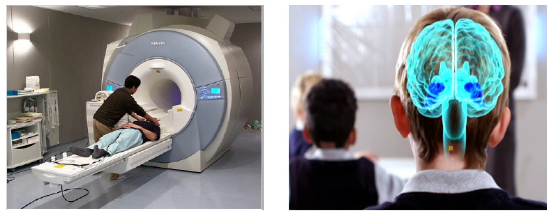 Científicos del Proyecto Cerebro humano afirman que están investigando el cerebro con tecnología no invasiva, como la Resonancia magnética funcional (Izq), no con implantes cerebrales, se muestra una recreación gráfica de un implante cerebral en niño en clase (derecha).