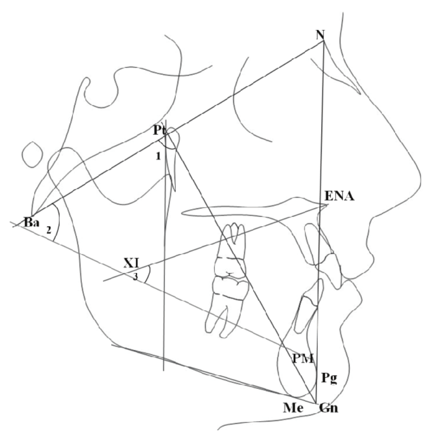 Figure 1. Angular measurements used to determine the facial types.