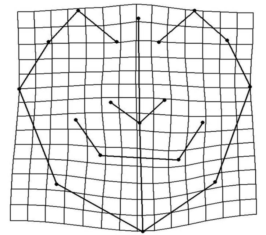 Figure
4. TPS graphical display of shape differences
between mesofacial and the dolichofacial group (magnification factor, X3).