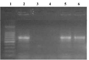 Productos de PCR para el gen blaZ (674pb) en S. aureus aislados de ambientes hospitalarios: carril 1: marcador de PM; carril 2 cepa control positivo; carriles 3 cepa control negativo; carriles 4 cepa negativa: carriles 5 y 6, cepas positivas.