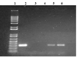 Producto de PCR para el gen mecA (310 pb) en S. aureus aislados de ambientes hospitalarios: Carril 1 marcador de PM, Carril 2 cepa control positivo, Carril 3 cepa control negativo, carril 4 cepa negativa, carriles 5 y 6 cepas positivas.