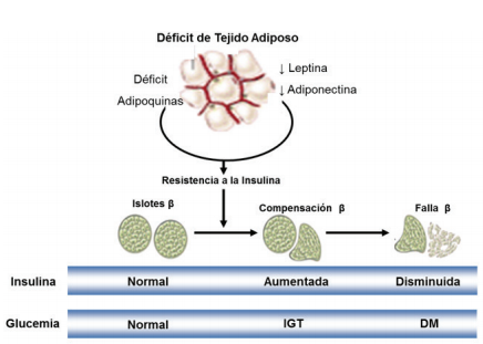 Historia natural de la diabetes mellitus en las lipodistrofias generalizadas. La ausencia de tejido adiposo conduce a un d&eacute;ficit en la s&iacute;ntesis y secreci&oacute;n de leptina y adiponectina, lo cual produce resistencia a la insulina. En etapas iniciales existe una compensaci&oacute;n por parte de las c&eacute;lulas beta que se asocia con hiperinsulinemia e intolerancia a la glucosa (IGT). Si la resistencia a la insulina persiste en el tiempo, ocurre finalmente falla de c&eacute;lula beta y por tanto disminuye la secreci&oacute;n de insulina con la consiguiente hiperglucemia en rango de diabetes mellitus (DM).