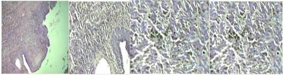 Revisi&oacute;n de l&aacute;minas