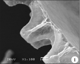 Sección de los tubérculos donde se observan los aeropilos en el interior.