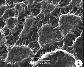 Celdas de la zona de transición del huevo de L. albicans. Si bien no es habitual, encontramos huevos de esta especie con las paredes entre celdas deprimidas, como el de la imagen.