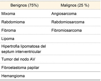 Clasificación de los tumores cardiacos