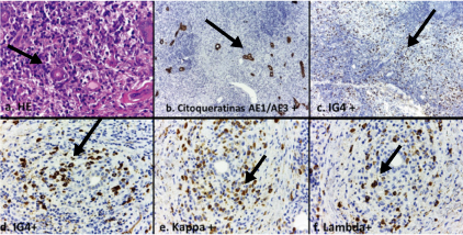 Corte histol&oacute;gico de piel periorbitaria