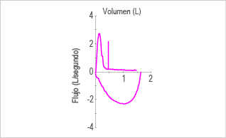 Obstrucci&oacute;n grave. 