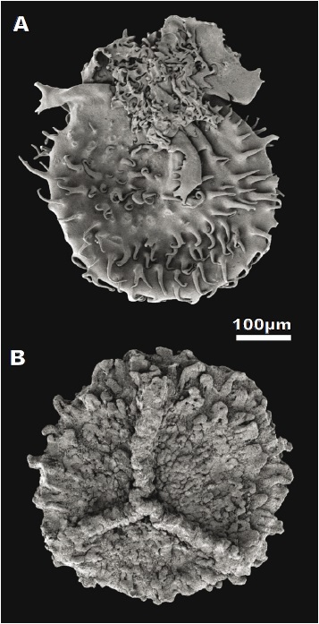 Examples of megaspores from the upper Turonian of SainteMondane (Unit I).