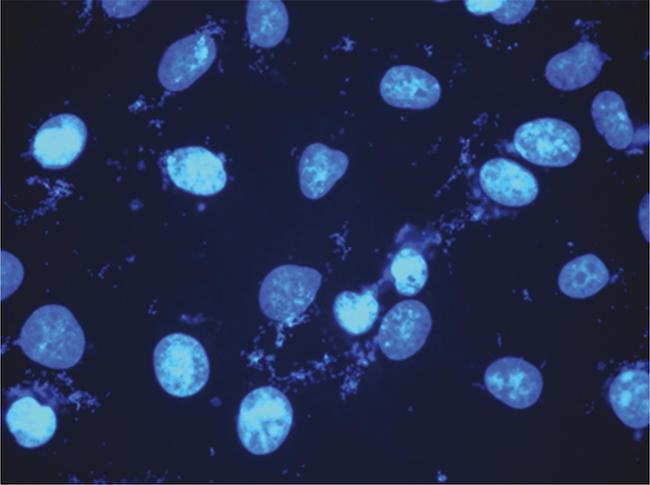 Células em monocamada contaminadas por micoplasmas e coradas com DAPI. São observados os núcleos corados, pela marcação do DNA e também o DNA dos micoplasmas presentes no citoplasma ou membrana das células, dando o típico aspecto de “céu estrelado”. Foto gentilmente cedida pelo Dr. Alberto Fraile-Ramos.