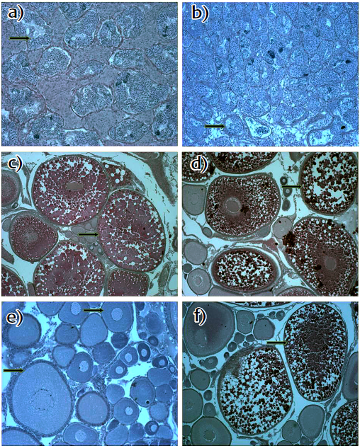 Transverse section of gonads.