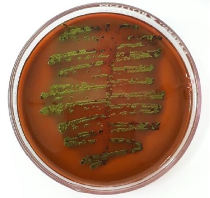 Cultivo de Escherichia coli. La muestra se obtuvo de orina de una paciente embarazada que cursaba con IVU. Se observa el color característico verde metálico de las colonias en medio eosina y azul de metileno (EMB). 