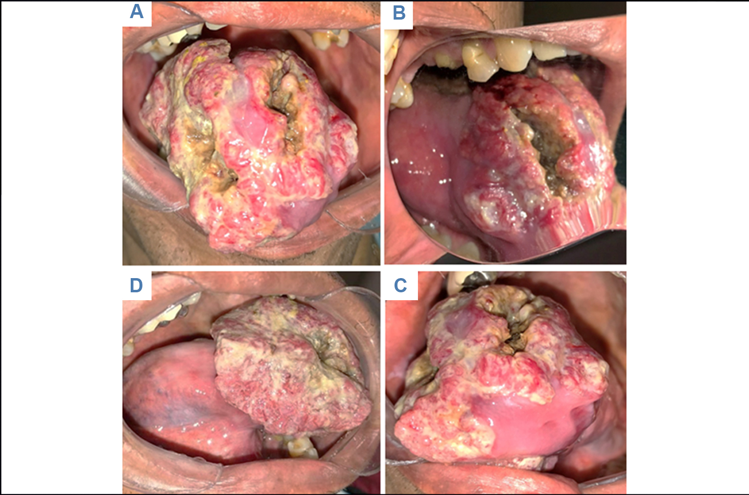 Fotograf�as intraorales