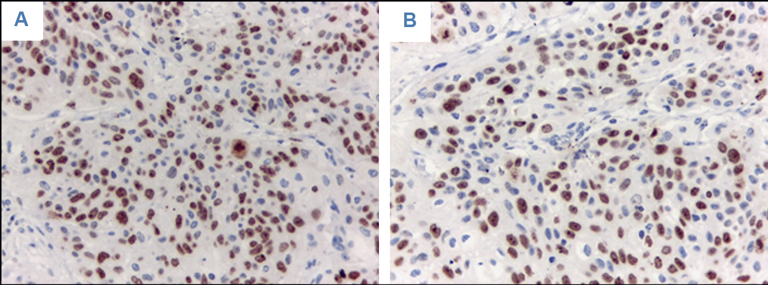 Fotograf�as microsc�picas con el anticuerpo Ki-67