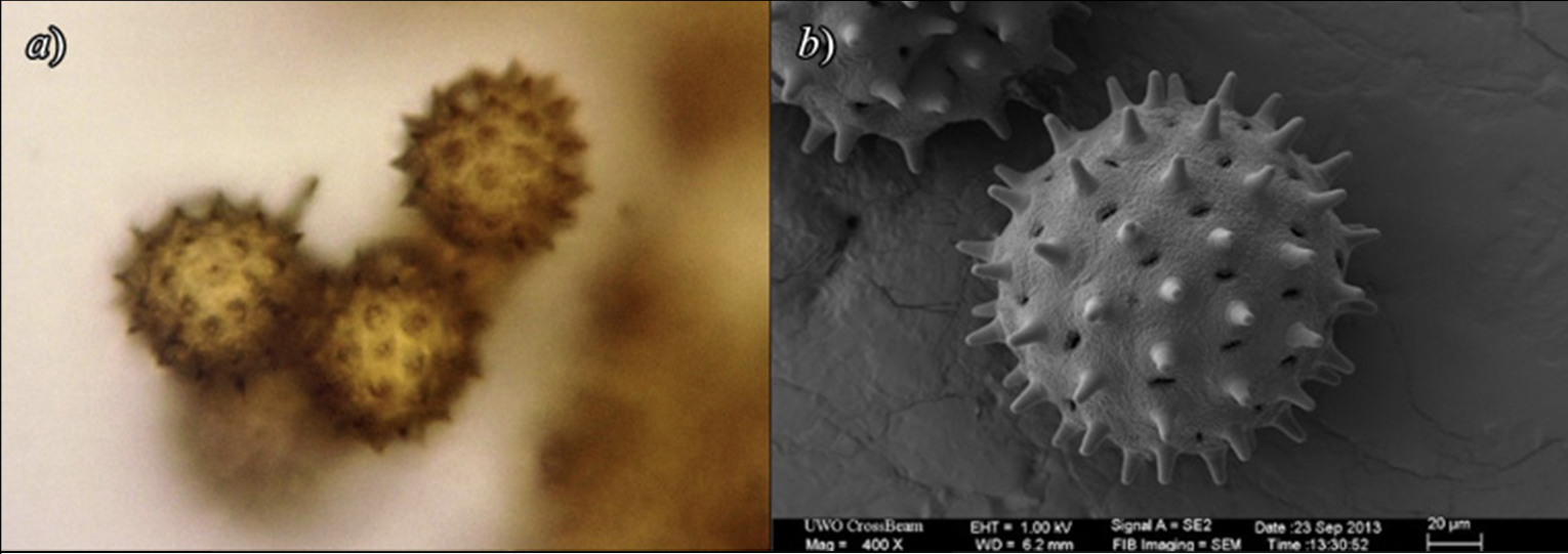 Comparativa de imgenes de granos de polen tomadas con diferentes microscopios