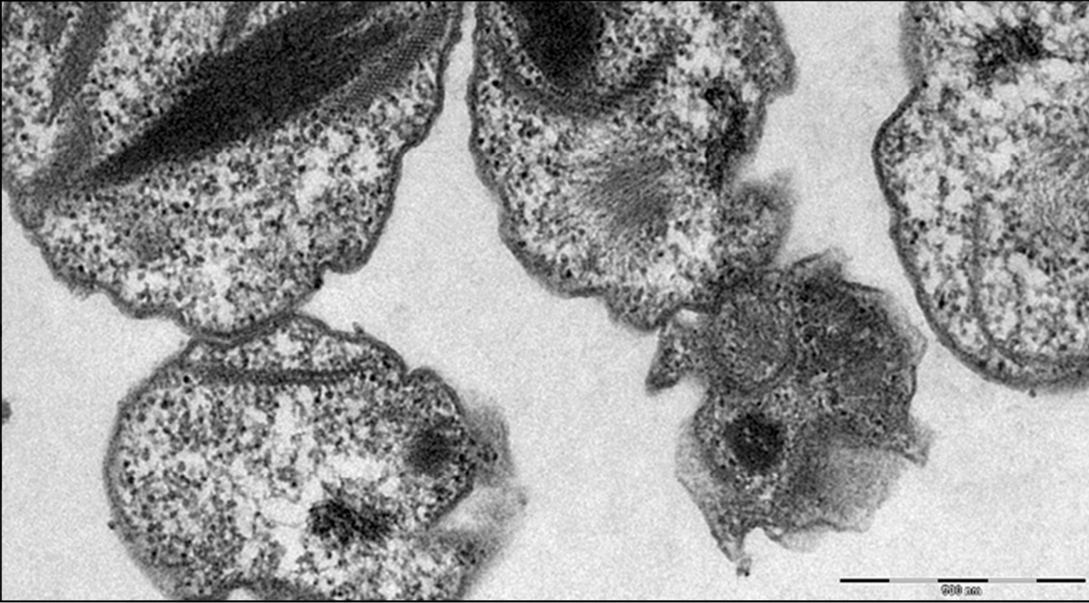 Bacteria Diplorickettsia massiliensis obtenida mediante microscopa electrnica de transmisin