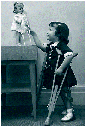 &bull; Ni&ntilde;a en muletas jugando con mu&ntilde;eca en muletas, Canad&aacute; | Tomada de: Revista Canadiense de Estudios de Discapacidad