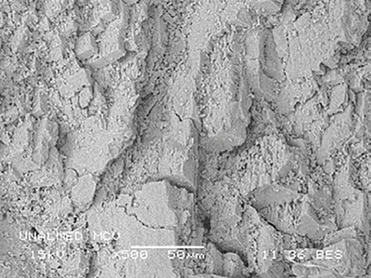 MBE a 500X de la MCV.