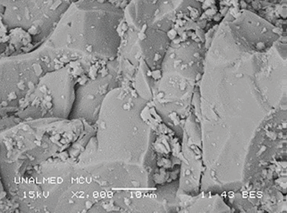 MBE a 2 000X de la MCV