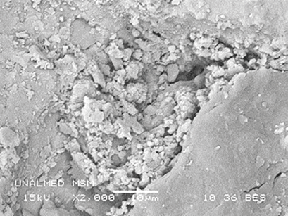 MBE a 2 000X de la MSM. 