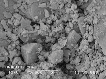 MBE a 5 000X de la MCV. 