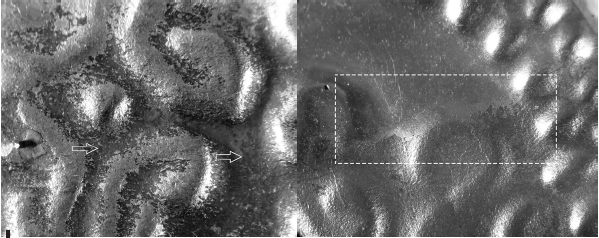 Regiones de la franja de color marr&oacute;n-negruzco de la nariguera bicolor Poli 13, donde se puede ver (11a) los compuestos granulosos que evocan productos de corrosi&oacute;n y (11b) que el substrato parece ser blanco