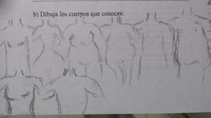 Cuerpos diversos corporales (con algunos signos de intervenciones quirrgicamente extraccin de mama) (ECBPO4)