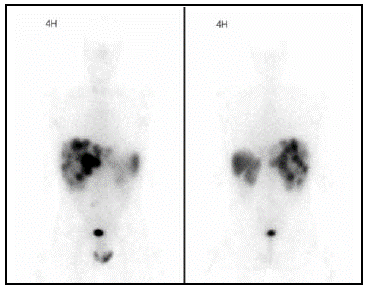 TAC abdominal con contraste.