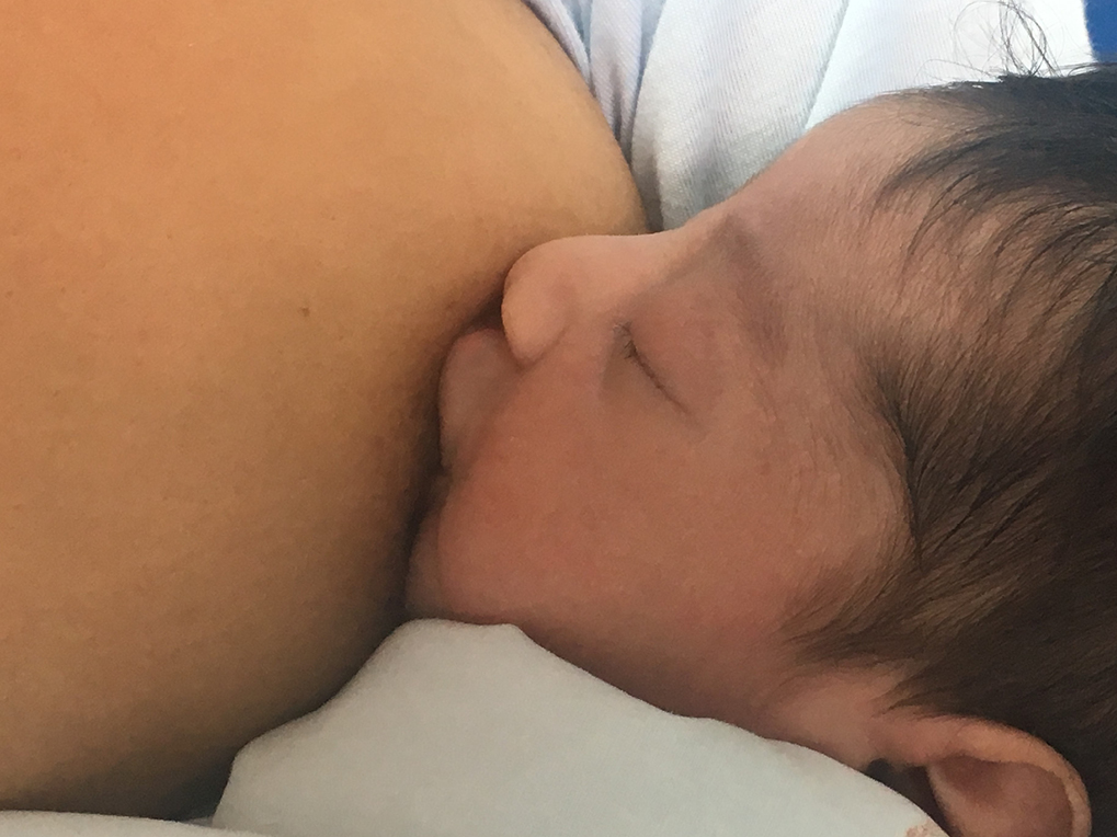 Newborn placed in the breast immediately after the surgical procedure
