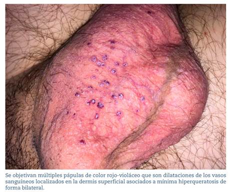 Aspecto cl�nico de las lesiones