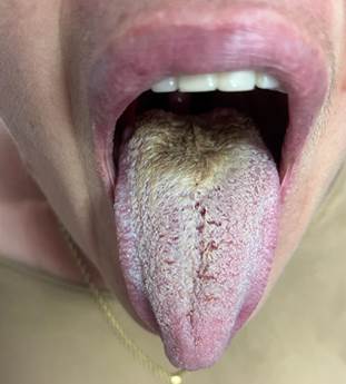 Seguimiento tras 6 meses