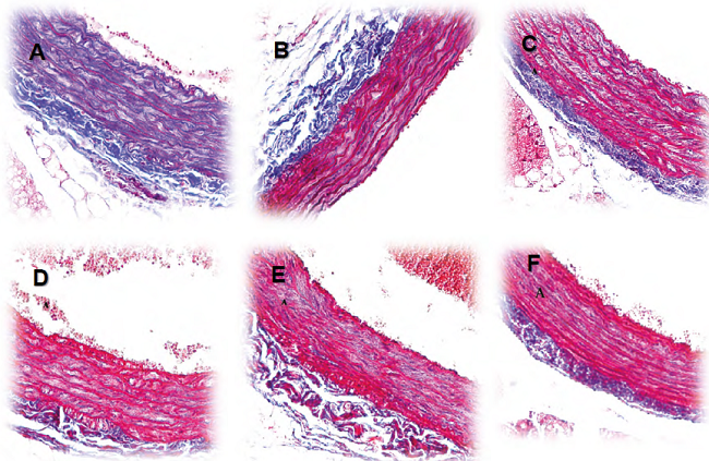 Representative pictures of aortic tissue sections stained with Masson&rsquo;s trichrome (100&micro;m) obtained from Wistar rats previously treated with L-NAME plus vehicle (panel A, control group), L-NAME plus enalapril (panel B, reference group), vehicle without L-NAME (panel C, blank group) and L-NAME plus P. quadrangularis L. (75, 150 and 300 mg/kg, p.o. Panels D, E and F, respectively).