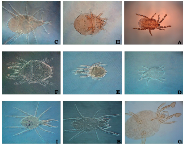Families of mites suborder Prostigmata associated to soil of the Natural Reserve Yotoco. A) Bdellidae, B) Scutacaridae, C) Smarididae, D) Stigmaeidae, E) Cryptognathidae, F) Eupalopsellidae, G) Cunaxidae, H) Pseudocheylidae, I) Microtrombidiidae.