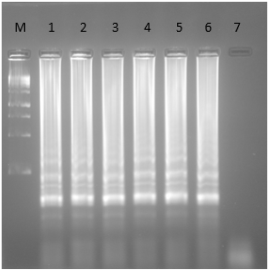 Corrido electrofortico en gel de agarosa al 1.5 % de productos de RT-LAMP para el virus ToBRFV en semillas de tomate en Colombia, en el que se muestra un barrido con mltiples amplicones tipo ladder-like pattern. M: marcador de peso molecular de 1 kb Thermo Scientific. Lneas 1 a 5 corresponden a las muestras de semilla de tomate SLT1 a SLT5, respectivamente. 6: control positivo (ToBRFV_Italia). 7: control negativo (NTC).
