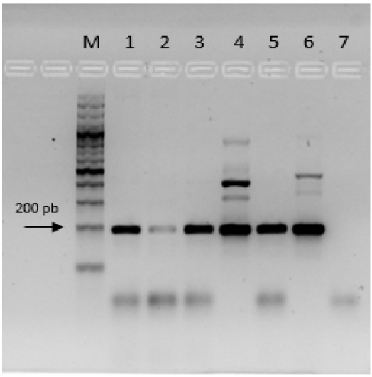 Corrido electrofortico en gel de agarosa al 1.5 % de productos de RT-PCR con los primers B3 y F3 para la identificacin del virus ToBRFV en semillas de tomate en Colombia. M: marcador de peso molecular de 100 pb Thermo Scientific. Lneas 1 a 5 corresponden a las muestras de semilla de tomate SLT1 a SLT5, respectivamente. 6: control positivo (ToBRFV_Italia). 7: control negativo (NTC).