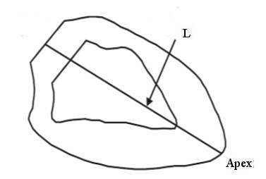Ventricular contours aligned.
