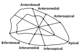 Segments division of the LV applied to X-ray ventriculography.