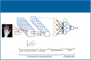 Arquitectura de una Redes Neuronales Convolucionales