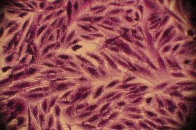 . Normal untreated MCF-7 Cells
