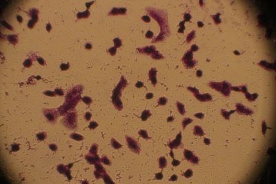 Morphological changes in MCF-7 cells after treated with DOX