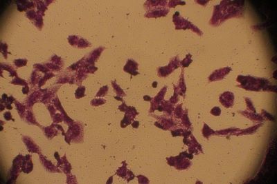 Morphological changes in MCF-7 cells after treated with compound II