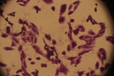 Morphological changes in MCF-7 cells after treated with compound IV