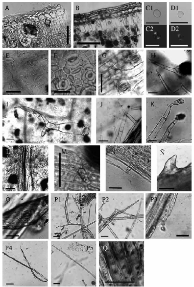 A-B. Cortes de hoja: A. Celtis ehrenbergiana, B. Jodina rhombifolia; C-D. Almidones J. rhombifolia; E-G. Clulas epidrmicas y estomas: E. Nicotiana tabacum, F. C. ehrenbergiana, G. Ephedra tweediana; H-. Tricomas: H. Verbena litoralis, I. N. tabacum, J. N. tabacum, K. N. rustica, L. N. tabacum, M. Schinus longifolia, N. Artemisia vulgaris, . E. tweediana; O. Epidermis E. tweediana; P. Fibras J. rhombifolia: P1-2, tipo a; P3, tipo b; P4, tipo c; P5, tipo d, Q. E. tweediana. Escala 50 μm
