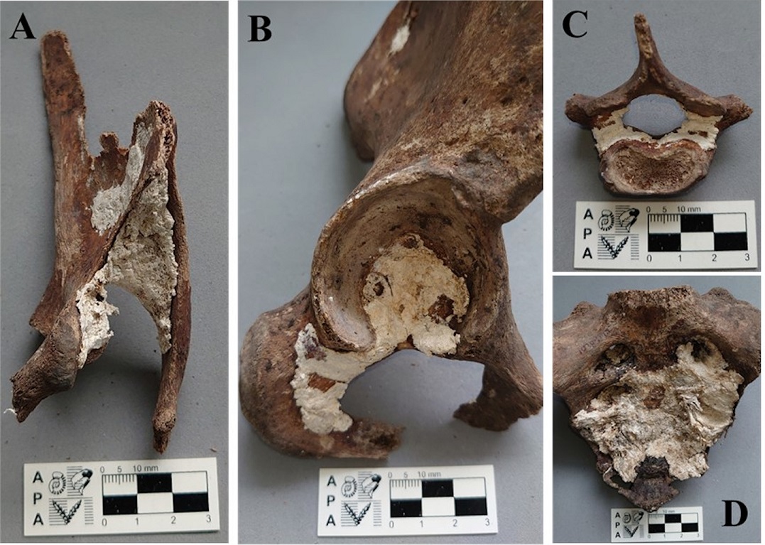 Modificaciones tafonmicas. Presencia de adipocira en A: escpula izquierda; B: coxal derecho; C: vrtebra cervical; D: sacro.