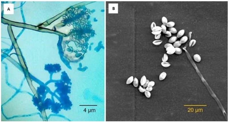 Microscopic characteristics of B. cinerea. A. Conidiophores with conidia observed by visible light microscopy and B. Conidia observed by SEM micrographs. 