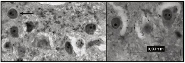 IMAGEN EN LA QUE SE OBSERVAN EJEMPLOS DE NÚCLEOS Y NUCLEOLOS DE NEURONAS TAL
COMO PERMITE VISUALIZARLOS LA TINCIÓN DE AGNOR