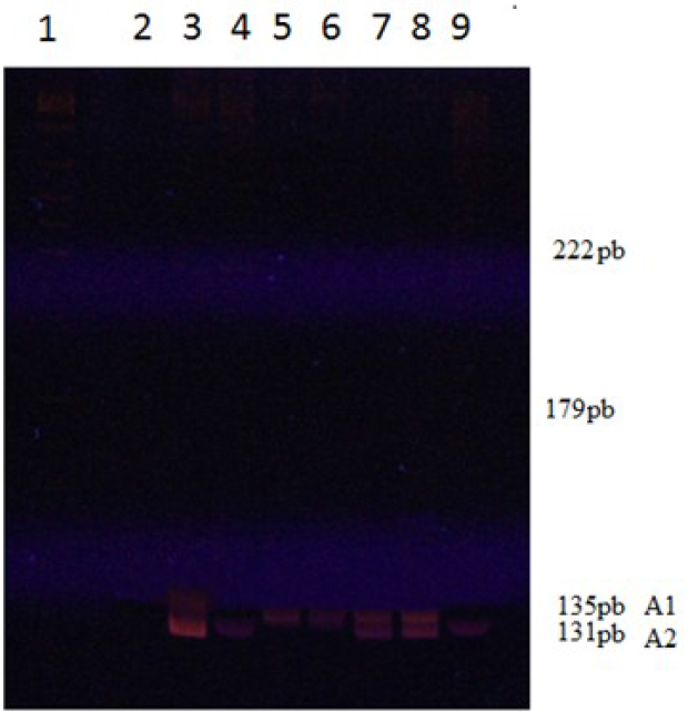 Patrón electroforético de alelos para STR 3´CA. Carriles en la parte superior: 1) patrón de peso molecular pGEM; 2) control negativo; 3) tía del enfermo (II-1); 4) abuela maternal (I-1); 5) enfermo (III-2); 6) abuelo materno (I-2); 7) madre del enfermo (II-3); (8) hermana del enfermo (III-1); y (9) padre de III1 (II-2). A la derecha, la talla estimada de los alelos A1 y A2 para este marcador y la talla de algunos de los fragmentos del patrón de peso molecular que mejor se visualizaron.
