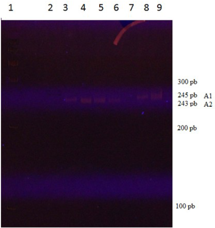 Patrón electroforético de alelos para STR 49. Carriles en la parte superior: 1) Patrón de peso molecular GelPilot® 100 pb; 2) control negativo; 3) padre de III-1 (II-2); 4) hermana del enfermo (III-1); 5) madre del enfermo (II-3); 6) abuelo materno (I-2); 7) enfermo (III-2); 8) abuela materna (I-1); y 9) tía del enfermo (II-1). Son heterocigotas II-3 y III-1. A la derecha, la talla estimada de los alelos A1 y A2 para este marcador y la talla de algunos de los fragmentos del patrón de peso molecular que mejor se visualizaron.