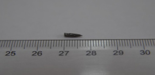 - Cuerpo extraño, alargado, compatible con una punta de lápiz, extraído en el acto quirúrgico.